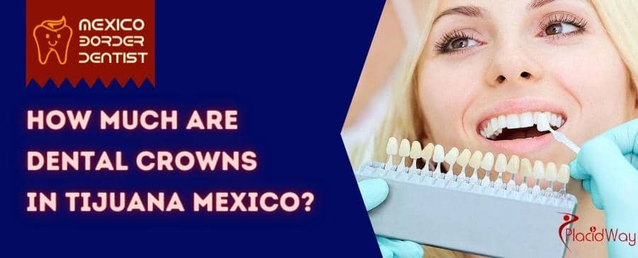 Compare Prices For Dental Work In Mexico