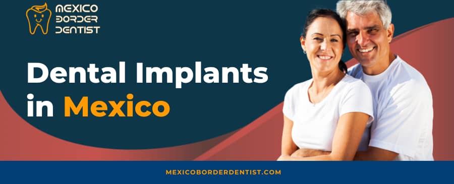 Dental Implants in Mexico