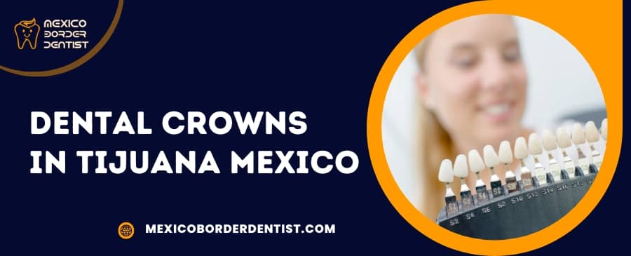 Which Are The Best Dental Crowns Clinics In Tijuana, Mexico?